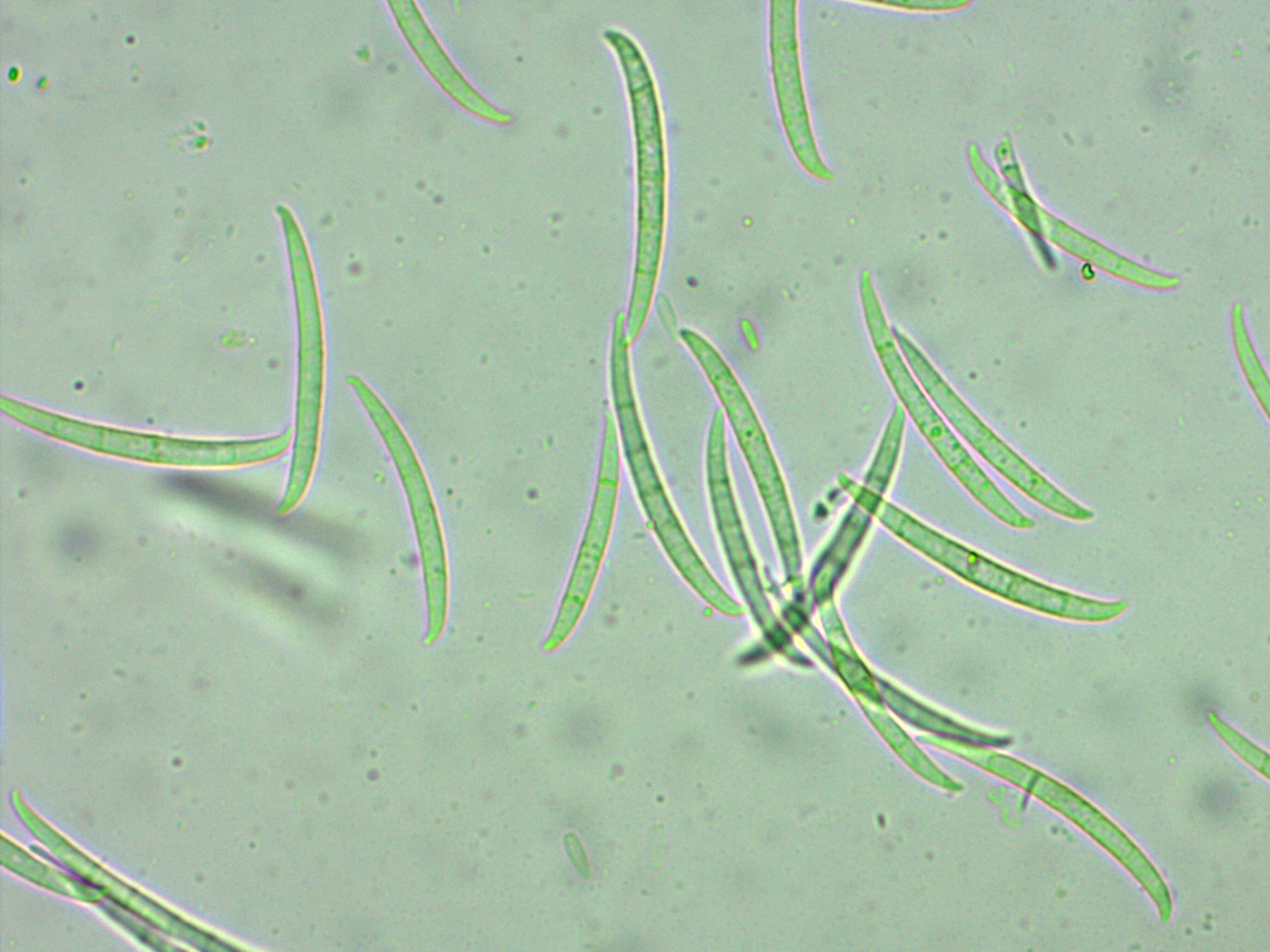 Identificación de Fusarium spp en esquejes (injerto / patrón)