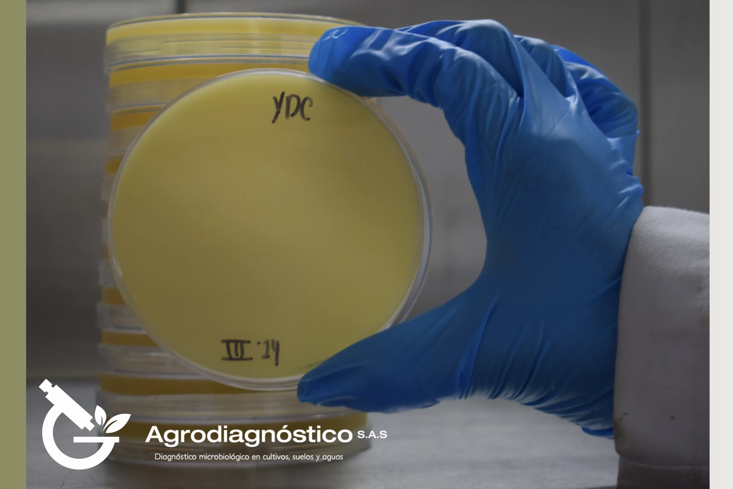 Medio de cultivo: YDC