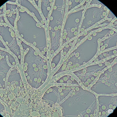 Recuento de microorganismo por grupos funcionales y/o biocontroladores