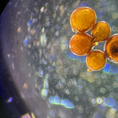 Analisis de micorrizas